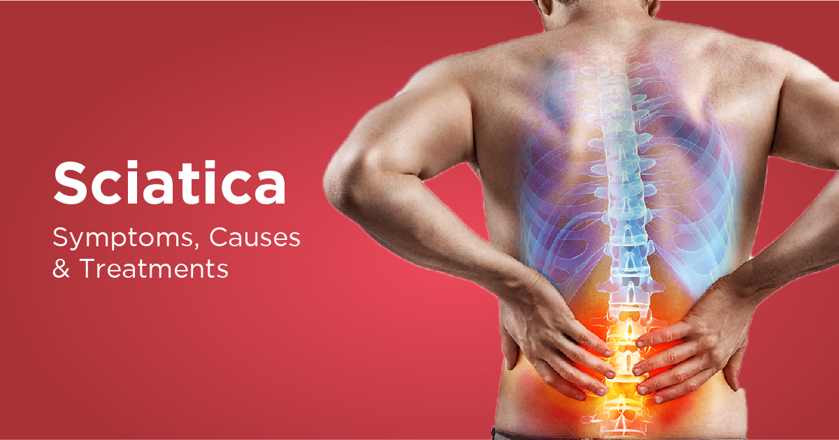 What is sciatica?